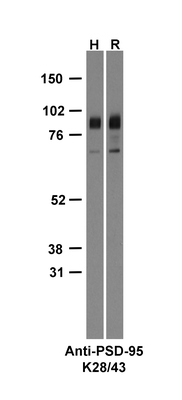 Western Blot image by James Trimmer, UC Davis