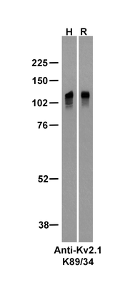 Western Blot image by James Trimmer, UC Davis