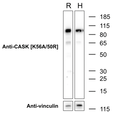 Western Blot image by Addgene