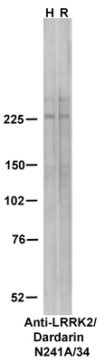 Western Blot image by James Trimmer, UC Davis
