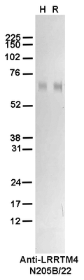Western Blot image by James Trimmer, UC Davis