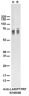 Western Blot image by James Trimmer, UC Davis
